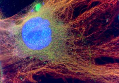 Astrocyte