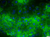 Liver cells accumulating lipids