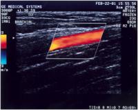 Ballerinas and Female Athletes Share Quadruple Health Threat (2 of 2)