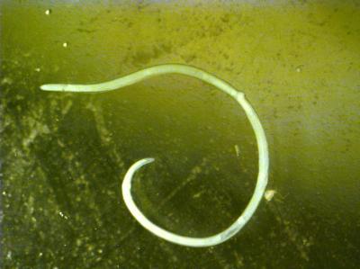 Anisakid Larva