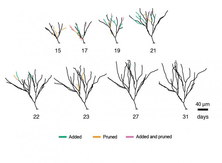 New Salk Study is First to Closely Follow Development of New Neurons in the Adult Brain
