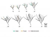 New Salk Study is First to Closely Follow Development of New Neurons in the Adult Brain