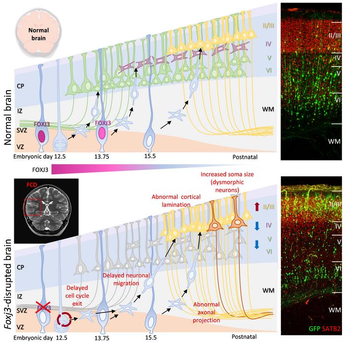 FOXJ3 is essential for proper cell fate determination and cortical lamination in deeper-layer and Layer 4 neurons.