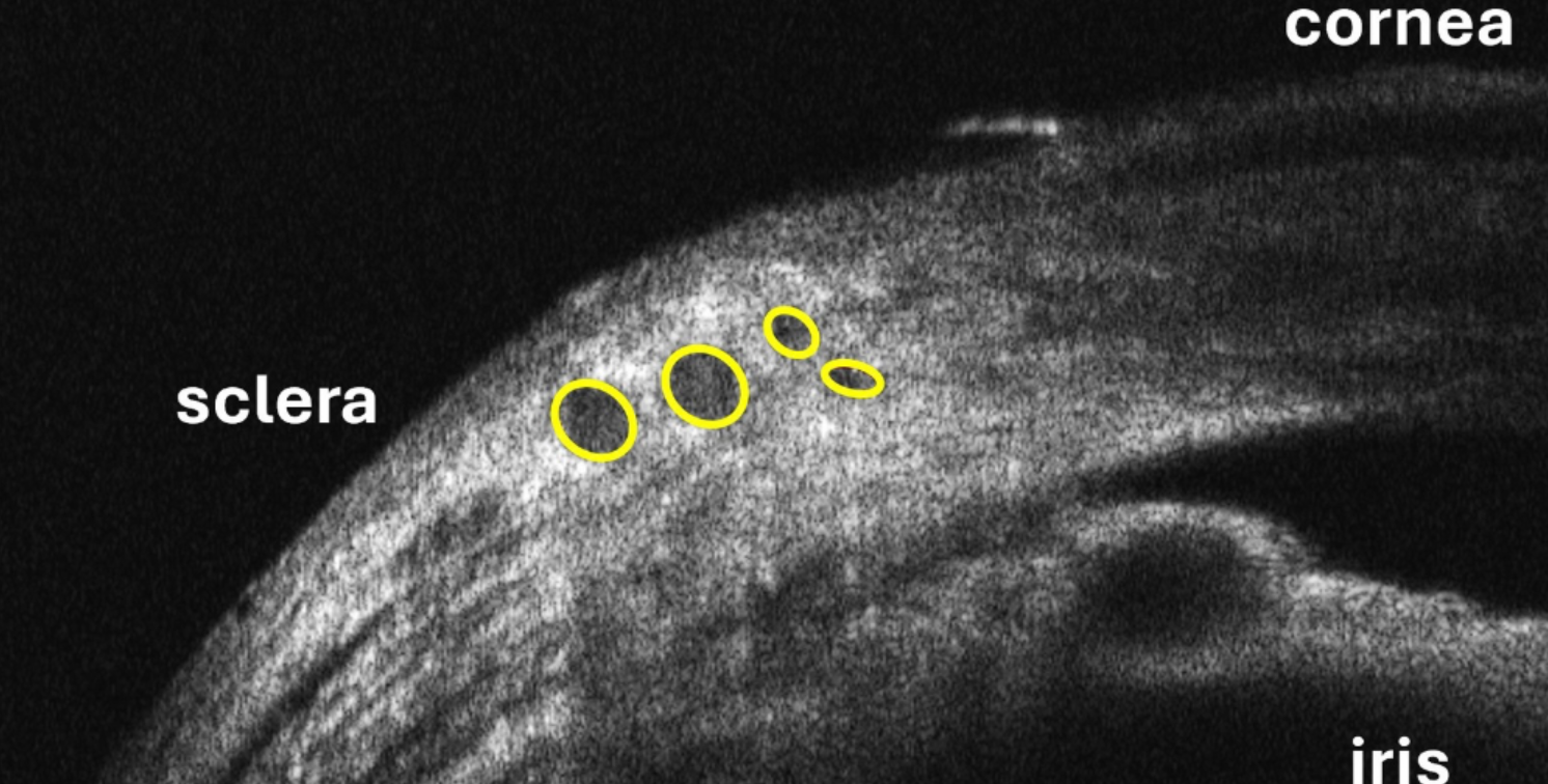 OCT imaging