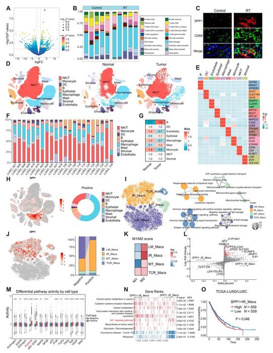 图 1.放疗后巨噬细胞中 SPP1 的上调及其与免疫抑制功能的相关性