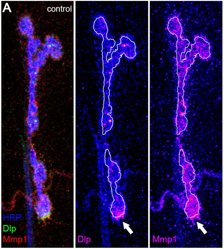 Special Issue: New Frontiers in Fragile X Syndrome: The Most Common Heritable Intellectual Disability (3 of 5)