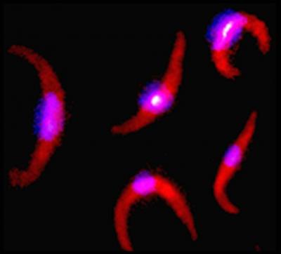 Phase 1 Progress in the Quest for a Malaria Vaccine (2 of 3)
