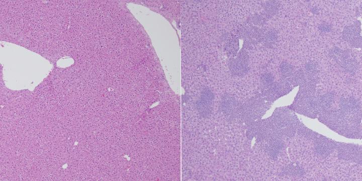 Members of the TET Protein Family Protect Against Cancer