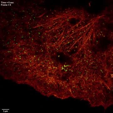 High Numerical Aperture Structured Illumination Microscopy (SIM) of Actin/Clathrin Interactions