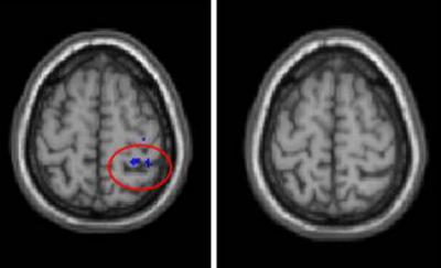 Brain