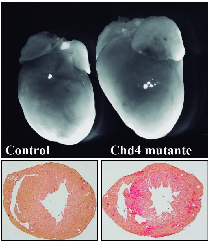 Chd4