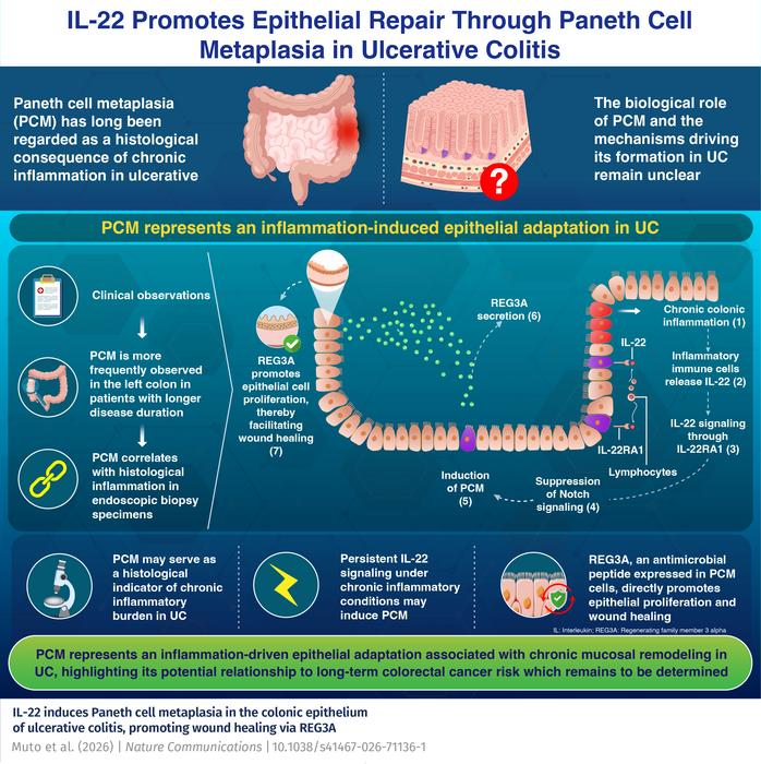 IL-22 Promotes Epithelial Repair Through Paneth Cell Metaplasia in Ulcerative Colitis