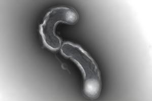 Transmission electron microscopy of LSUCC0530 cells