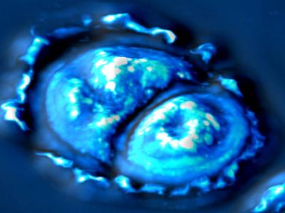 SLIM-imaged Cell
