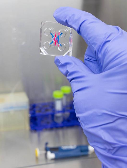 Organ-on-a-chip