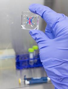 Organ-on-a-chip