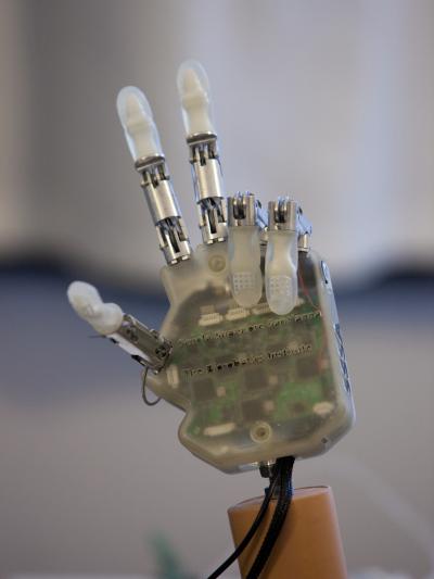 A 'Feeling' Prosthetic Hand (1 of 12)
