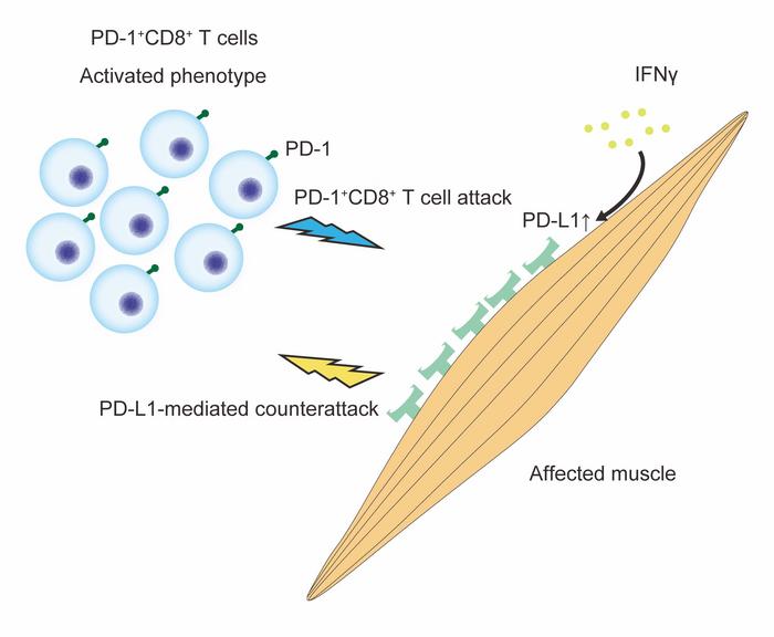 PD-1/PD-L1 pathway in the pathophysiology of idiopathic inflammatory myopathies