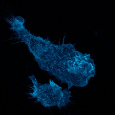 A Blue-Stained Macrophage