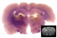 Molecular MRI