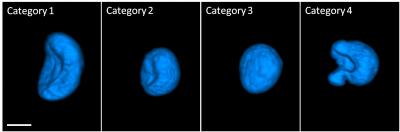 Human Mammary Epithelial Cells