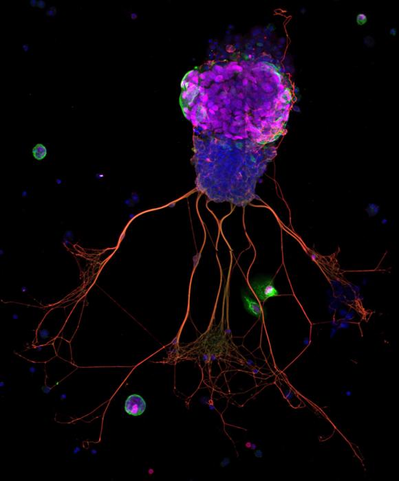 Brian Lin Tufts University research--organoid