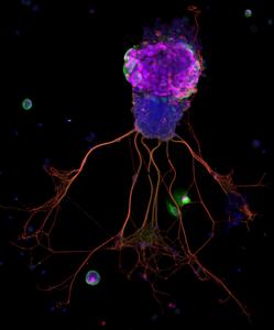 Brian Lin Tufts University research--organoid
