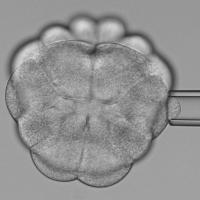 Measuring the stiffness of dividing cells