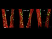Adult Drosophila motor terminals and muscles
