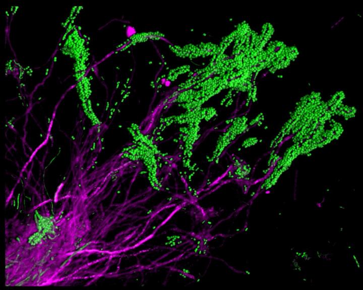 Fragment of Dental Plaque Showing Filamentous Bacteria Decorated by Spherical Bacteria
