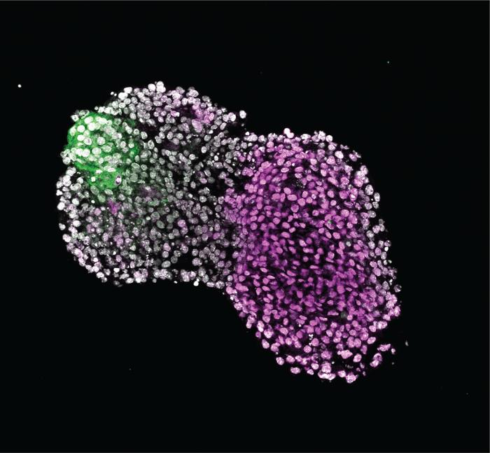 Fluorescence imaging of a budoid. Magenta: forming cartilage. Green: AER cells.