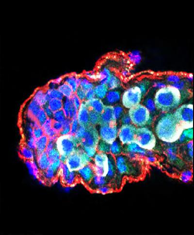 miRNAs Play a Key Role in Sexual Differentiation in the Fruit Fly