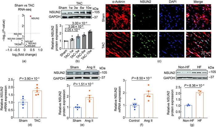 The expression of NSUN2 was upregulated in hypertrophic hearts.