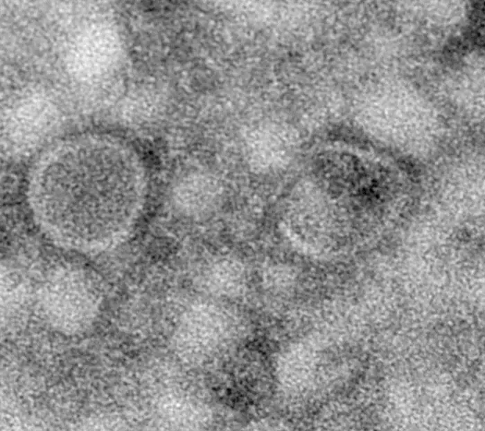 Extracellular vesicles