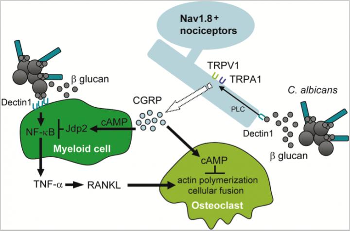 Pain Neuron