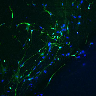 Mature Nerve Cells