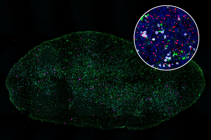 Lung Tumors