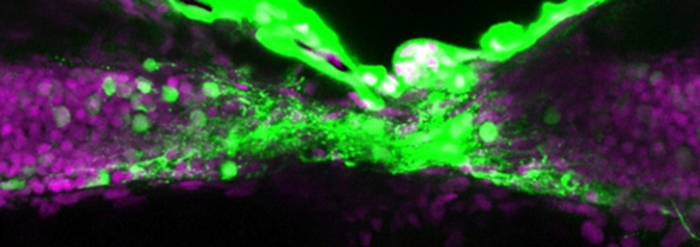 Spinal cord and neurons