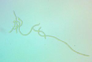 Filamentous cyanobacteria (Nostoc punctiforme)