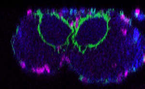 Larval brain