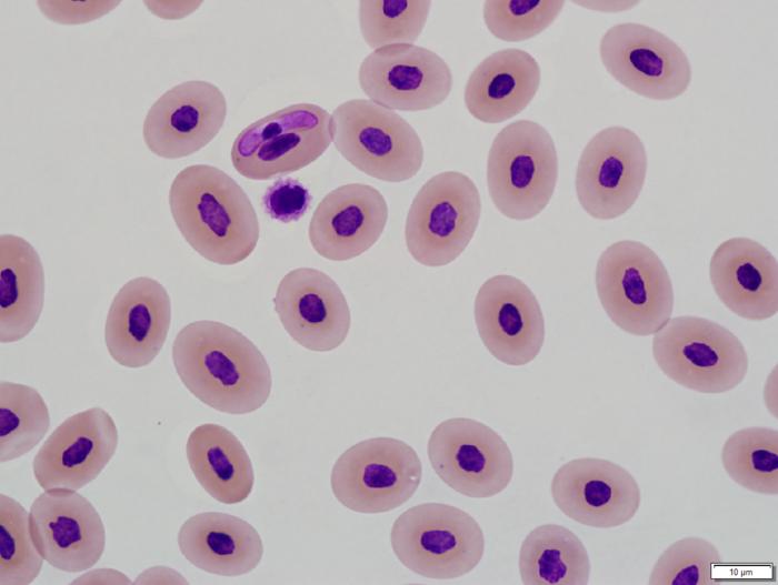 Banded watersnake blood with Hepatozoon spp.