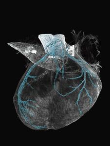 A developing heart