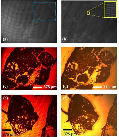 Hologram vs. Conventional Microscope