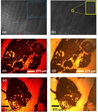 Hologram vs. Conventional Microscope