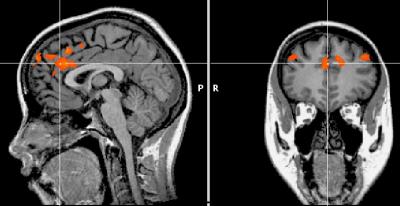 Brain Activity when People Exert Self-control