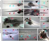 Conversion of Melanocytes to a Metastatic-Like State