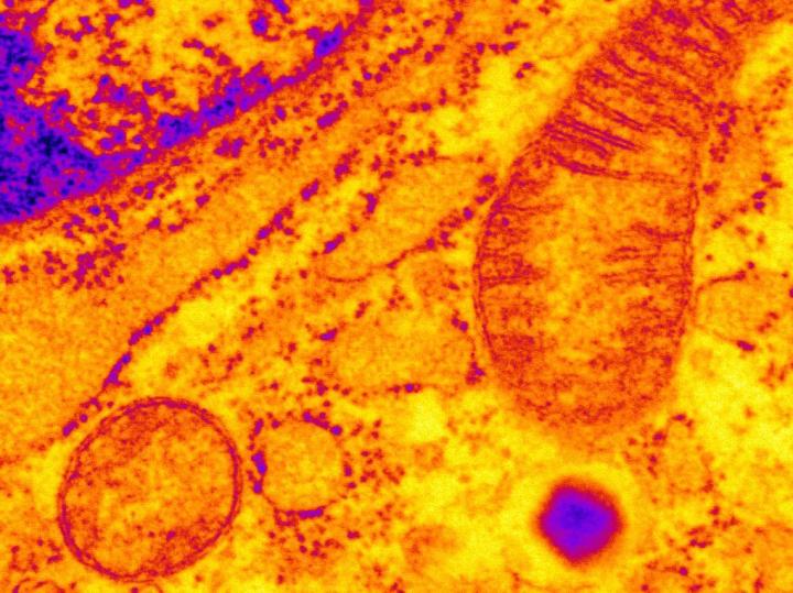 Microscope Image of a Pancreatic Beta Cell