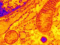 Microscope Image of a Pancreatic Beta Cell