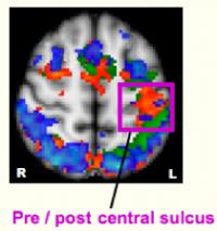Brain Image