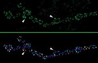 Calcium Channels Are Key